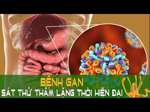 Bệnh gan: "Sát thủ" thầm lặng thời hiện đại | Sức khỏe vàng VTC16