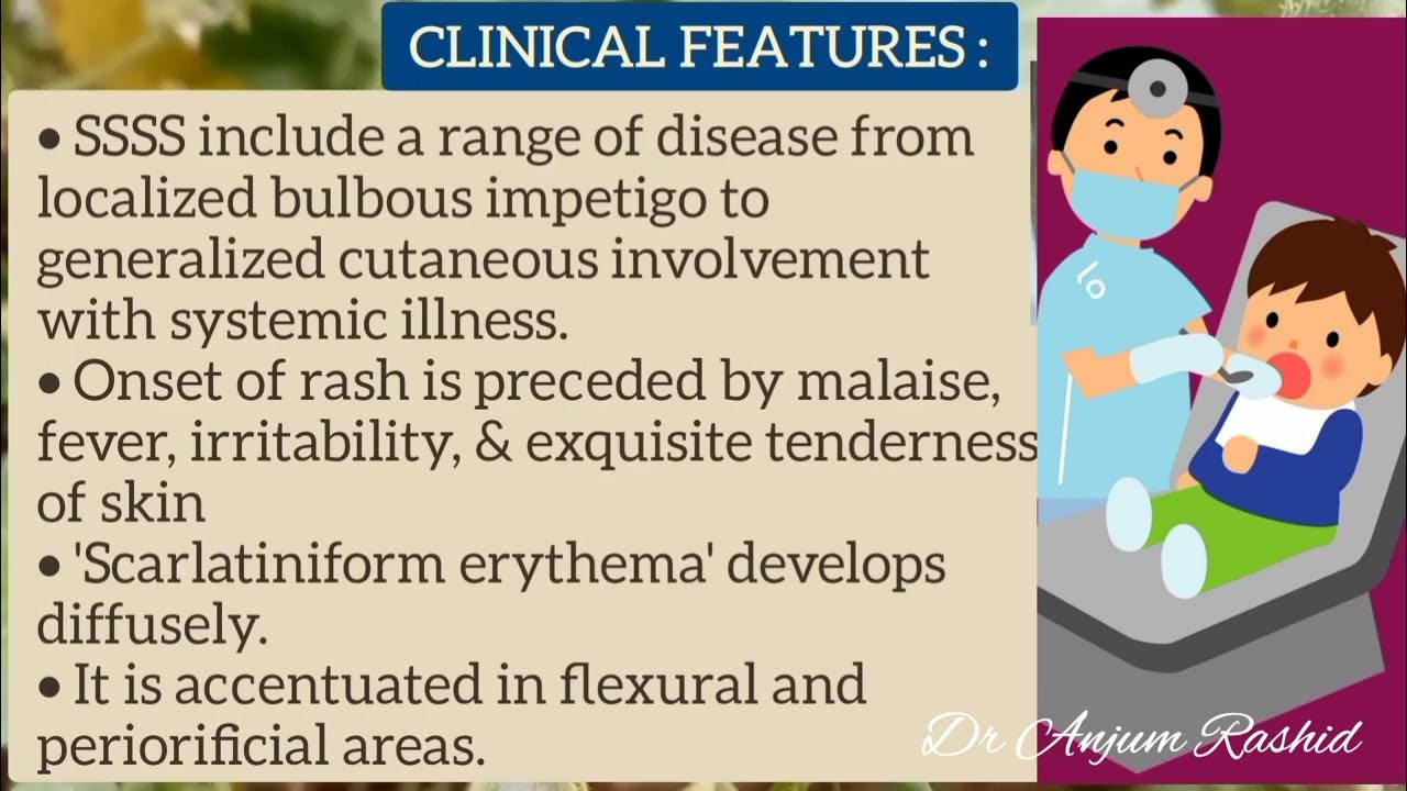staphylococcal-scalded-skin-syndrome-causes-symptoms-diagnosis