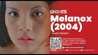 Iklan Melanox - Noda Wajah (2004)