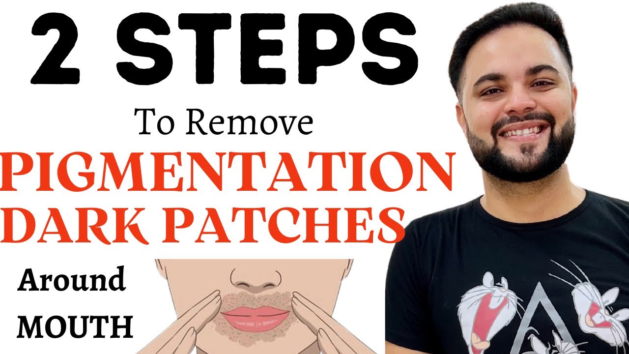 2-steps-to-remove-pigmentation-dark-patches-around-mouth-youtube