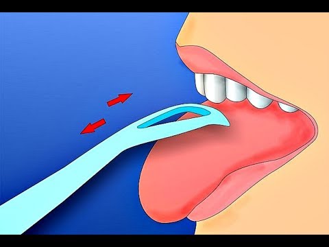 Как очистить язык от налета