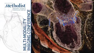 Cardiac CT: Current Technology & Basic Principles (Su Min Chang, MD) September 21, 2021