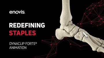 DynaClip Forte® Animation