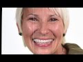 All-On-4 Dental Implants Cosmetic Dentistry - Anna's new smile!