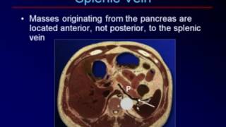 Sonography of the Pancreas and Spleen