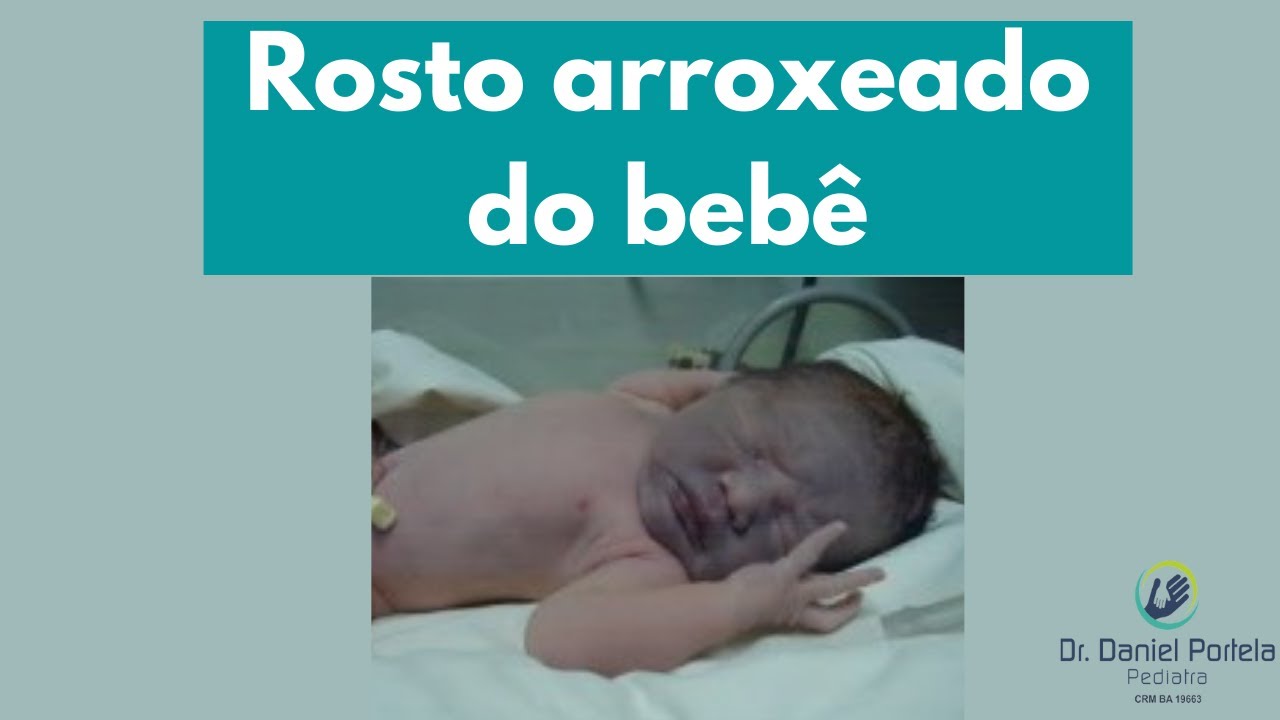 Mascara Equimotica Recem Nascidos - RETOEDU