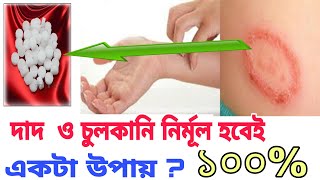 দাদ ও চুলকানির ডাক্তার দেখিয়ে হার মেনে গেছেন এই ভিডিওটা দেখুন নির্মূল হয়ে যাবে। | screenshot 5