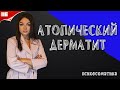 Атопический дерматит. Аллергический дерматит. Нейродермит. Психосоматика атопического дерматита