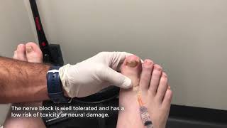 Local Anaesthetic for an Ingrown Toenail