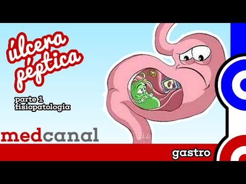 Vídeo: O que te predispõe à úlcera péptica?