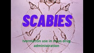 Scabies: Ivermectin use in mass drug administration
