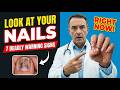 LOOK AT YOUR NAILS RIGHT NOW! 7 Signs of Deadly Disease You Keep Ignoring