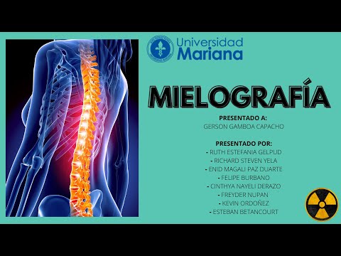 Video: ¿El mielograma es lo mismo que la mielografía?