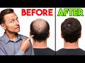 The #1 Missing Factor in Hair Loss