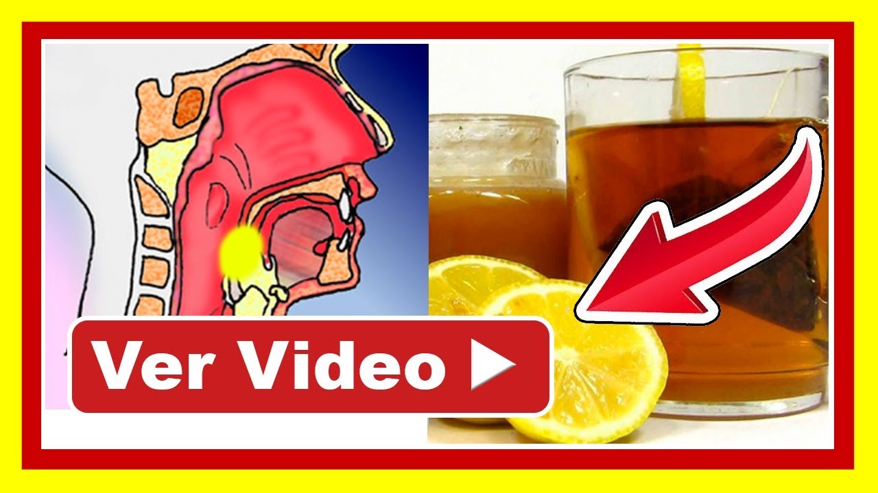 Como Se Quita El Ardor De Garganta www.youtube.com