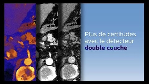 Scanner Philips : IQon Spectral CT