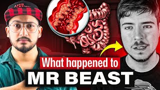 A Rare Disease that MrBeast is Suffering From😱