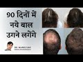 90 Days Hair Growth Transformation Challenge Use this SERUM FOR  Hair Growth I DR. MANOJ DAS