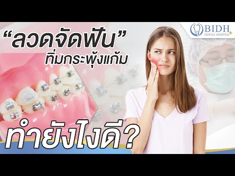 ลวดจัดฟันทิ่มกระพุ้งแก้ม ทำยังไงดี? หาคำตอบได้ที่ BIDH