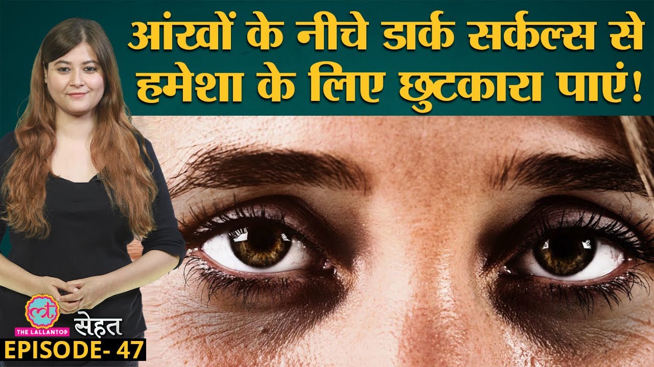 पूरी नींद होने पर भी Dark Circles यानी आंखों के नीचे काले घेरे क्यों पड़  जाते हैं?| Sehat Ep 47 - YouTube