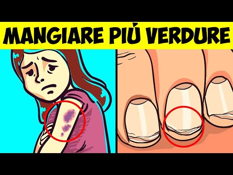 I 10 Segnali Che Indicano Che Non Mangi Abbastanza Verdure