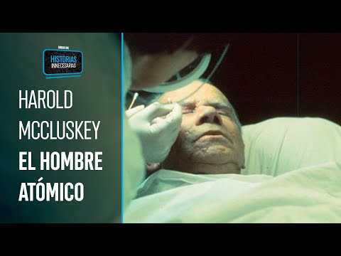 Harold McCluskey, el hombre ATÓMICO