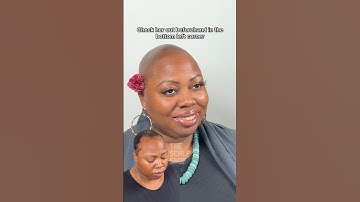 Female #HairLoss Transformation Before & After #scalpmicropigmentation #alopecia #result #haircut