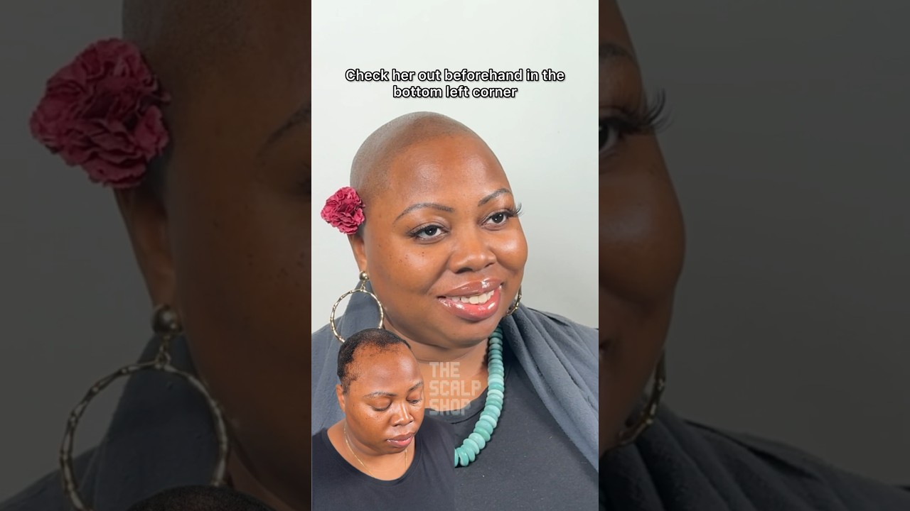 Female #HairLoss Transformation Before & After #scalpmicropigmentation #alopecia #result #haircut