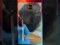 Folligrowtox Hair Growth Treatment | Real Results for Hair Regrowth & Thick, Healthy Hair