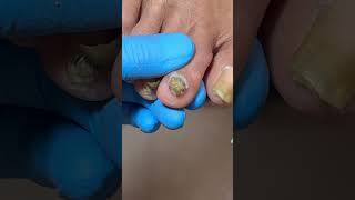 Satisfying pedicure video! #pedicure #toenails