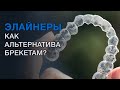 Что такое Элайнеры? Сравнение брекетов и элайнеров. Минусы и плюсы элайнеров.