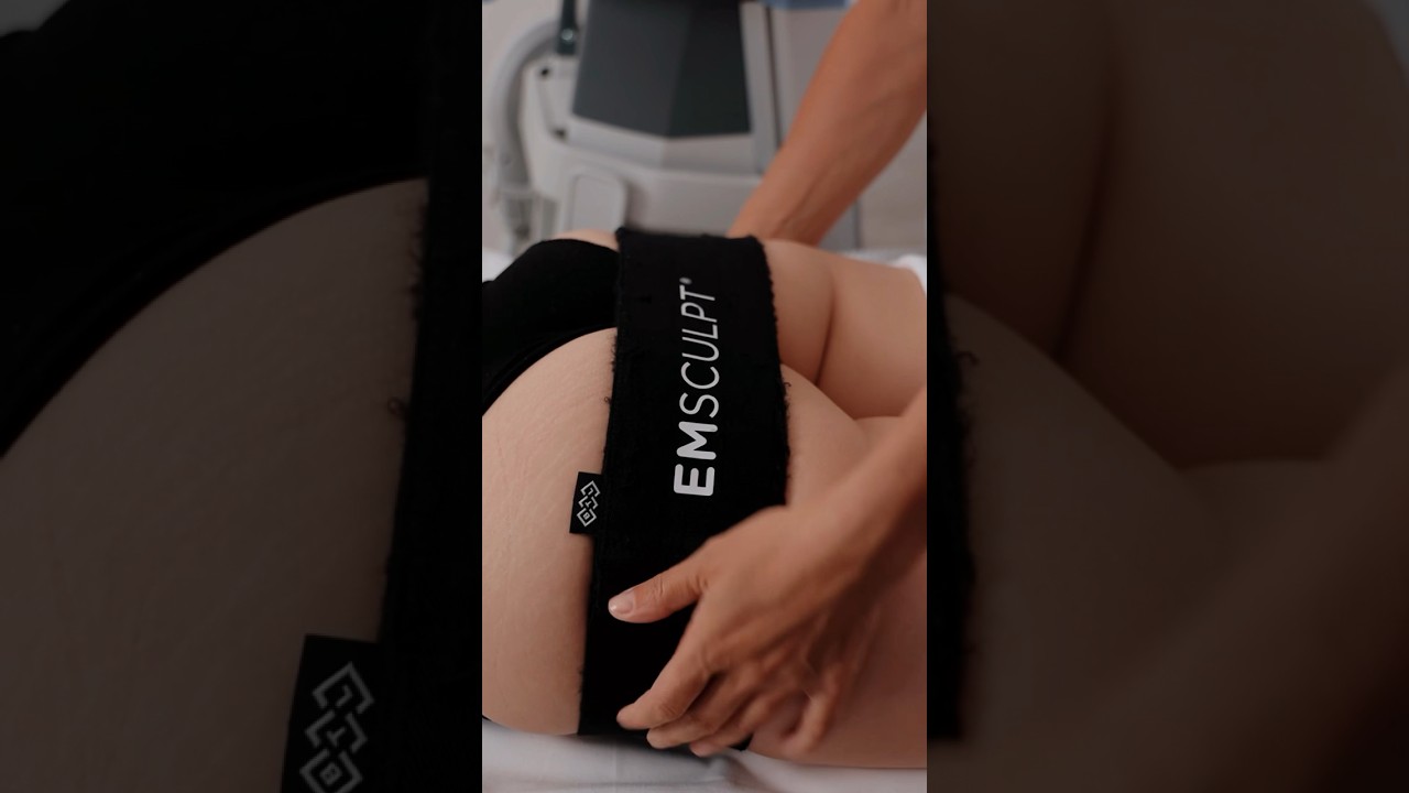 💎 ВЫТАЧИВАЕМ ФИГУРЫ С ПОМОЩЬЮ EMSCULPT В W SPA 