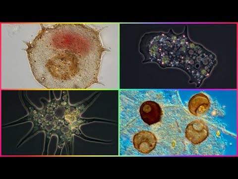 Vídeo: Quin tipus de protista és una ameba?