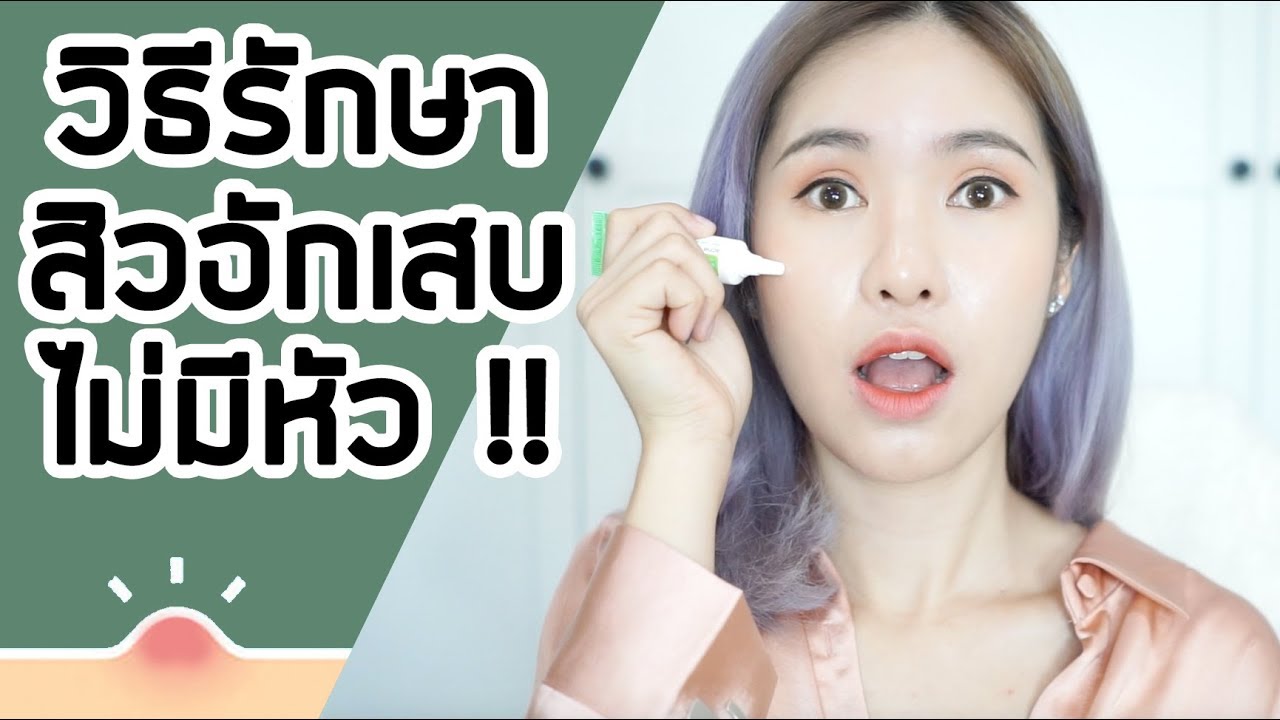 วิธีรักษาสิวอักเสบแบบไม่มีหัว จากประสบการณ์ส่วนตัว | mininuiizz