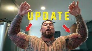 Arm Injury Update And Leg Day