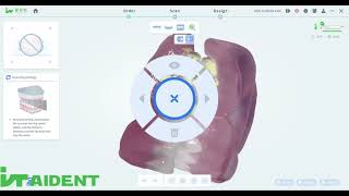 Aident AI-30 Intraoral Scanner Full Arch Model Scan | Under 60 Seconds + 10μm Accuracy