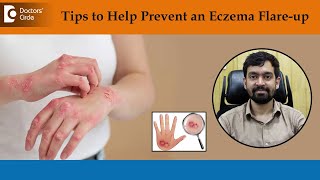 What Causes Eczema to Flare Up | How to Treat & Get Rid of EczemaDr.Rajdeep Mysore| Doctors' Circle