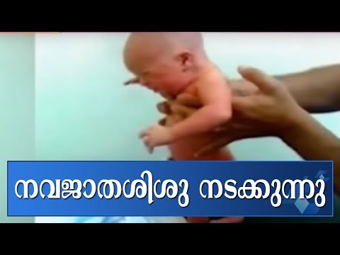 baby walking after birth viral video