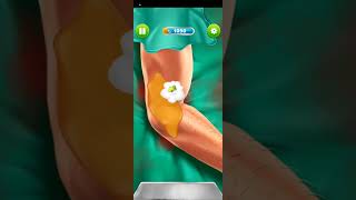 surgery doctor hospital || level 4 to 6 || doctor game || android gameplay screenshot 3