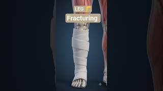 Bone fracturing #viral #3danimation #viralvideo #shorts #biology #pw @3d_Studystudios