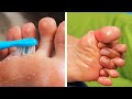 ¡Increíbles trucos de cuidado de pies para mantener tus piernas luciendo increíbles!