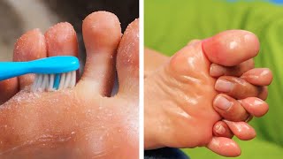 ¡Increíbles trucos de cuidado de pies para mantener tus piernas luciendo increíbles!