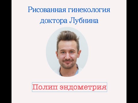 ПОЛИП ЭНДОМЕТРИЯ. Какие