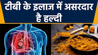 टीबी में हल्दी के इस्तमाल से मिलेगी राहत | TB के इलाज में फायदेमंद है हल्दी | Boldsky *health screenshot 1