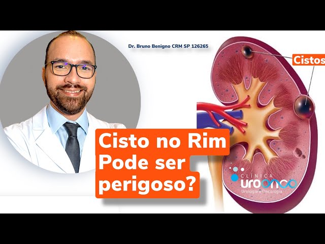 Cistos nos rins: O que é, quais os sintomas, causas, diagnóstico e