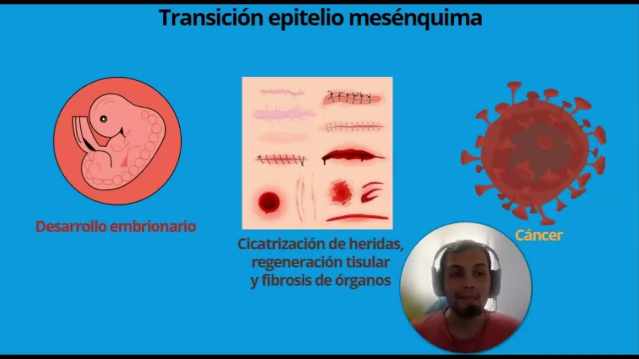 transición epitelio-mesenquima