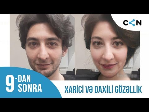 9-dan sonra (03.04.2019) / Xarici və daxili gözəllik