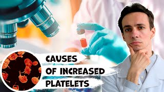 High blood platelets. What are the causes and what to do. Doctor gives hints