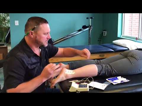 Iontophoresis in Physical Therapy