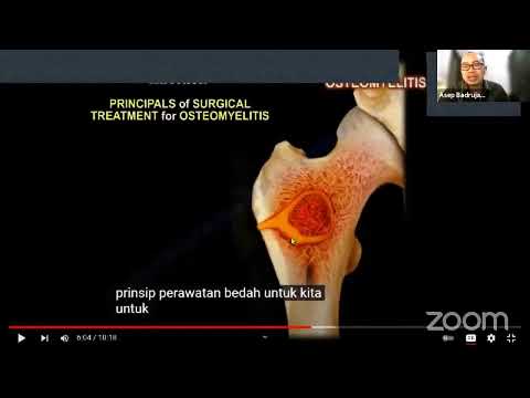 Osteoporosisi & Osteomielitis_KMB 2 D3_W 1 2021